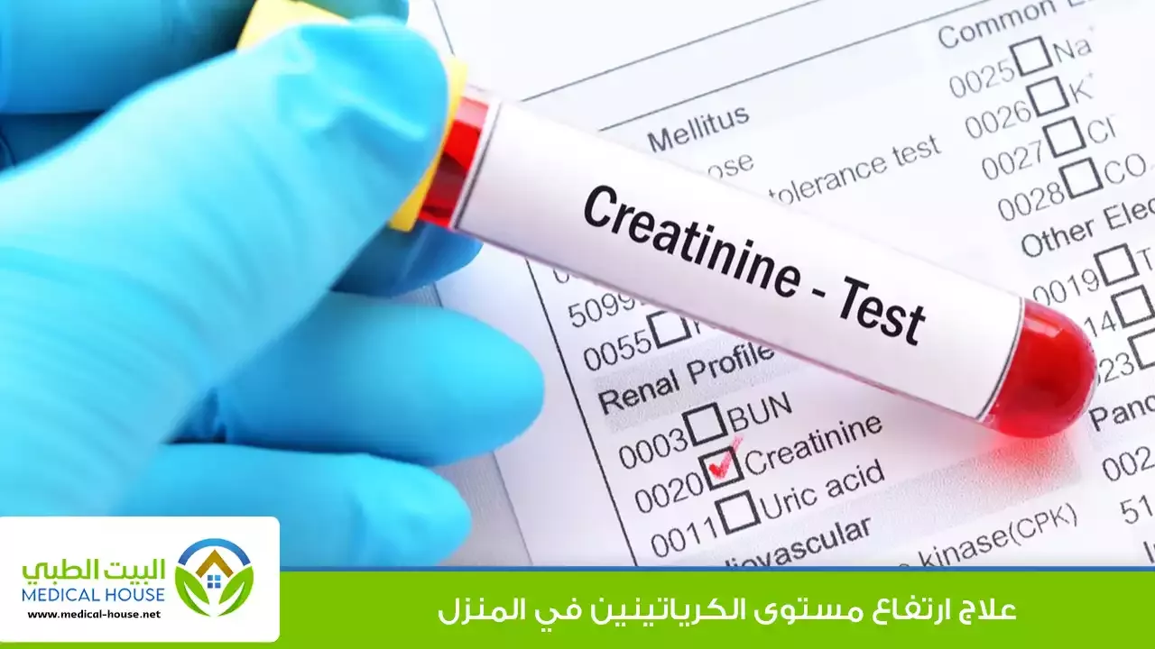 ارتفاع نسبة الكرياتينين في الدم – الأسباب وطرق خفض الكرياتينين بشكل طبيعي – البيت الطبي