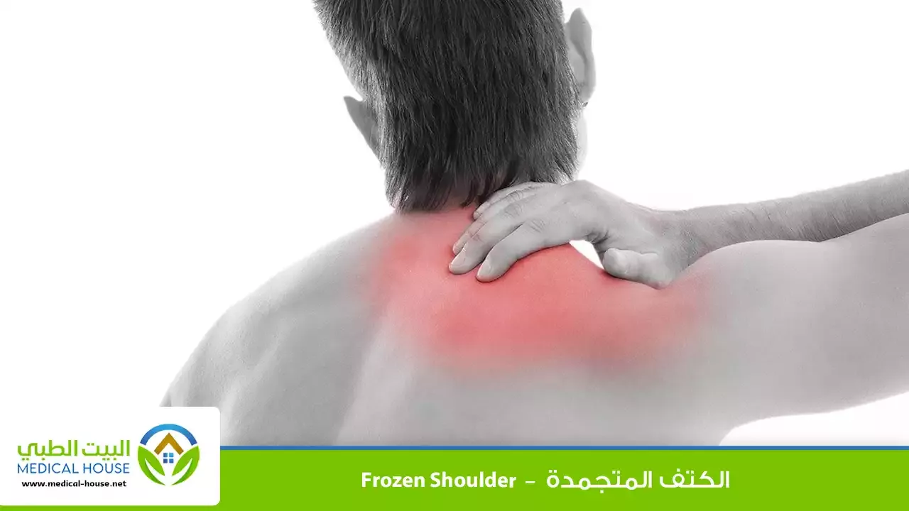 الكتف المتجمدة – ماهي؟، الأسباب والأعراض، التشخيص، العلاج والوقاية منها – البيت الطبي}}