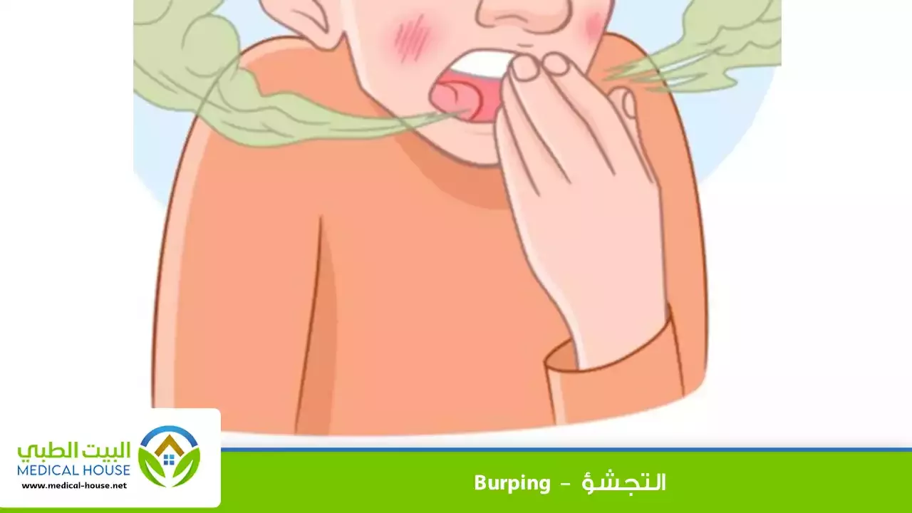 التجشؤ – ما هو، سبب حدوثه، طرق التخلص منه، متى يتوجب أخذ استشارة طبية – البيت الطبي