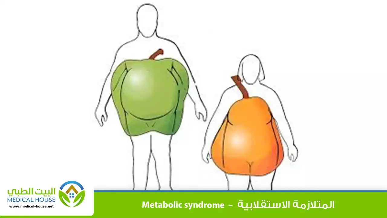 متلازمة التمثيل الغذائي – ما هو؟، الأعراض، المضاعفات، التشخيص، العلاج والوقاية – البيت الطبي
