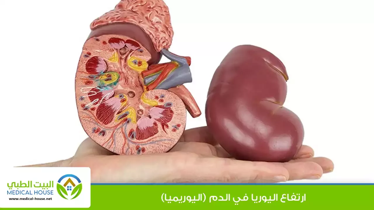 ارتفاع اليوريا في الدم – ما هو، أسبابه، أعراضه، مضاعفاته، العلاج والوقاية – البيت الطبي