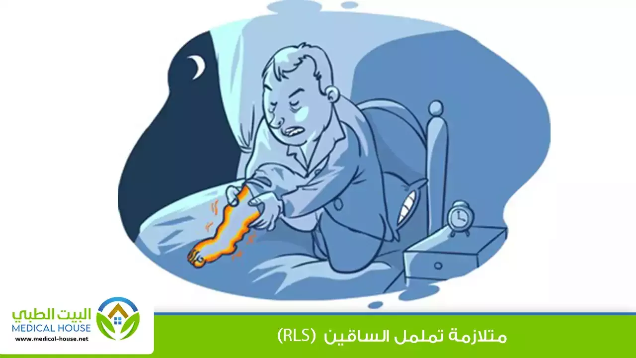 متلازمة تململ الساقين – الأسباب والأعراض، التشخيص والعلاج – البيت الطبي