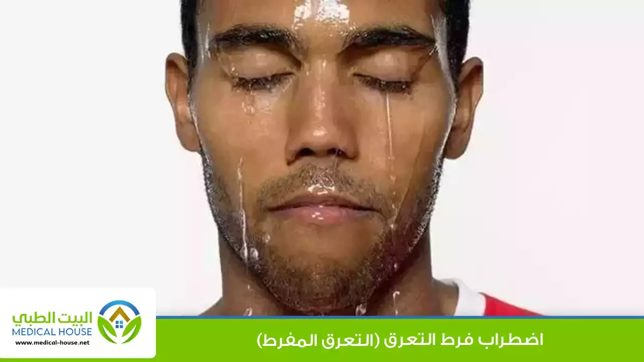 فرط التعرق – ما هو، أنواعه، الأسباب، الأعراض، التشخيص والعلاج – البيت الطبي