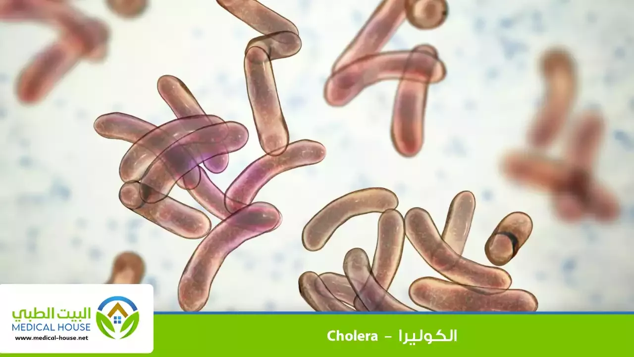 الكوليرا – ما هو، الأسباب، الأعراض، التشخيص، العلاج والوقاية منها – البيت الطبي