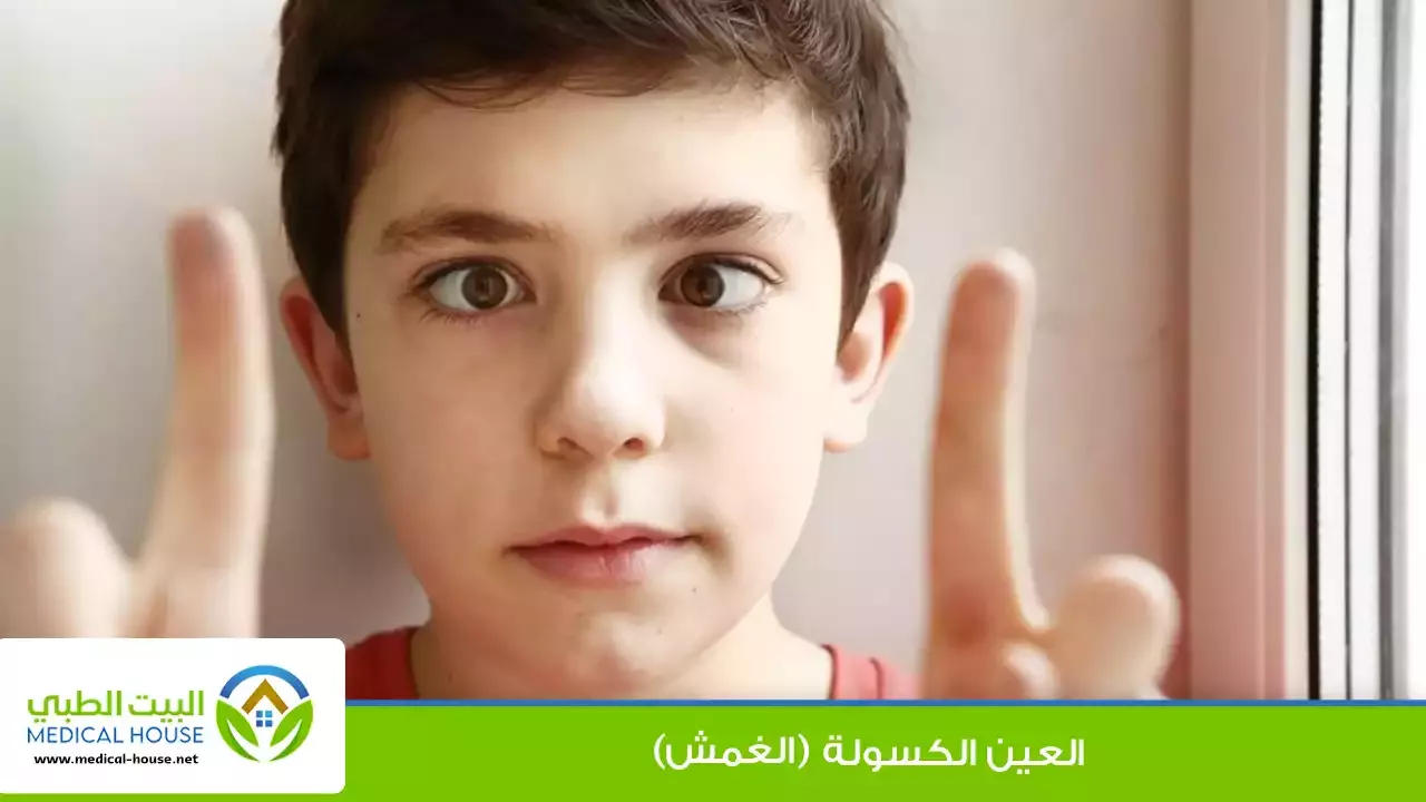 العين الكسولة (الغمش) – ماهي؟، العلامات، عوامل الخطر، التشخيص والعلاج – البيت الطبي