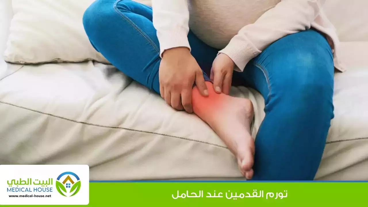 تورم القدمين عند الحامل – الأسباب والعلاج وطرق تخفيف تورم القدمين – البيت الطبي