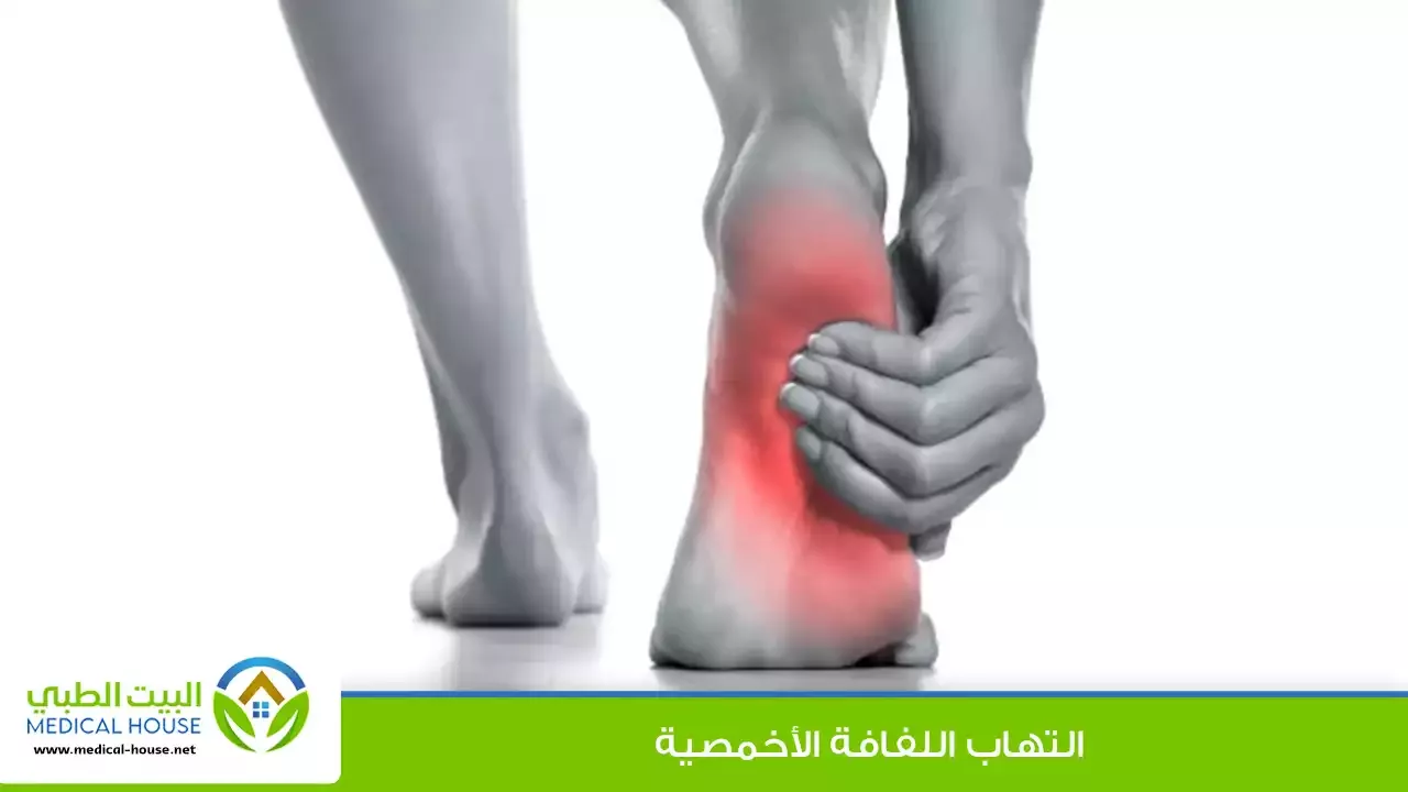 التهاب اللفافة الأخمصية – تعريفه، الأسباب، الأعراض، التشخيص، العلاج والوقاية – البيت الطبي