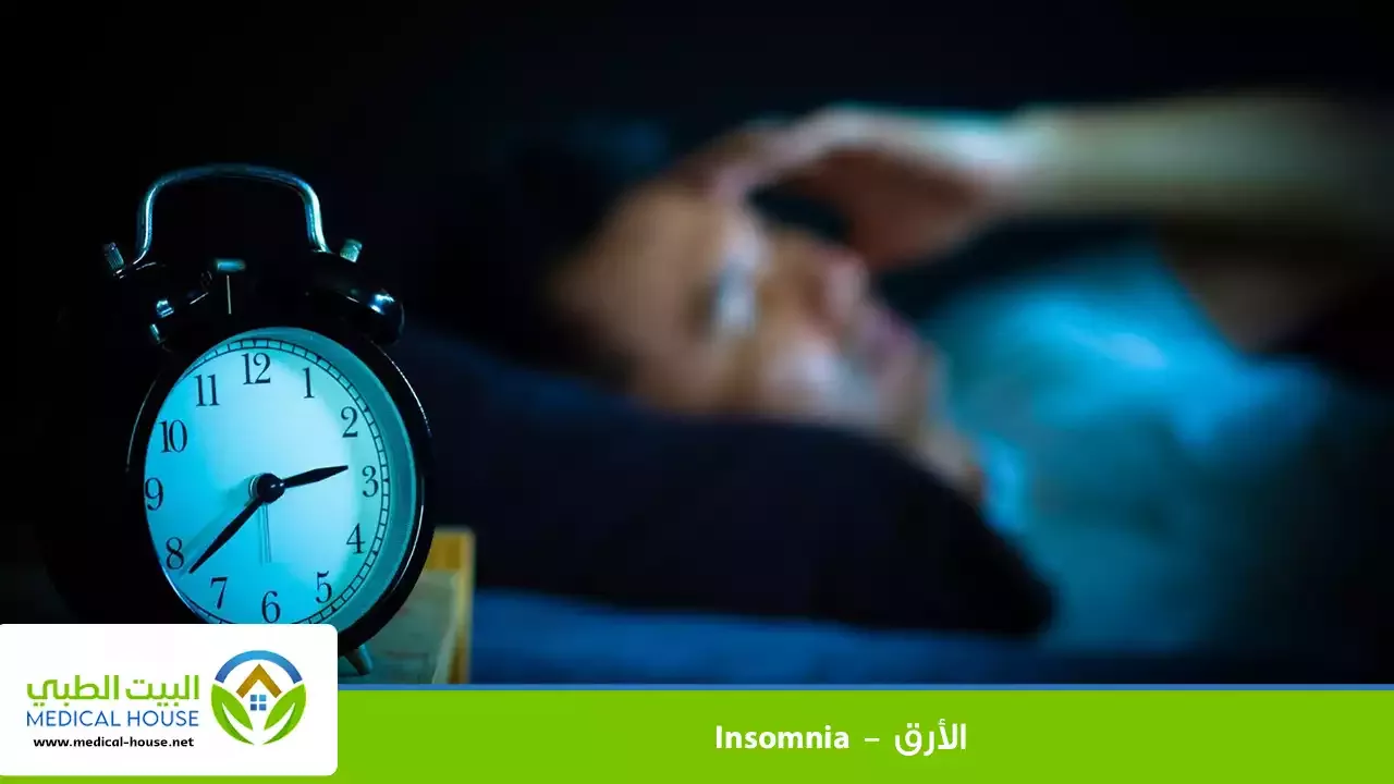 الأرق – ما هو، أنواعه وأسبابه، أعراضه، التشخيص، العلاج والوقاية وطرق التخلص منه