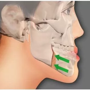 أ.د.طه الهبل