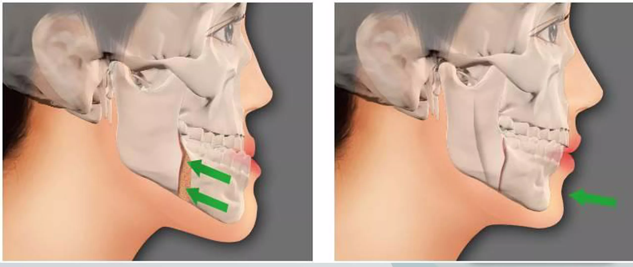 دكتور,طه,الهبل,جراحة,فكين,أسنان