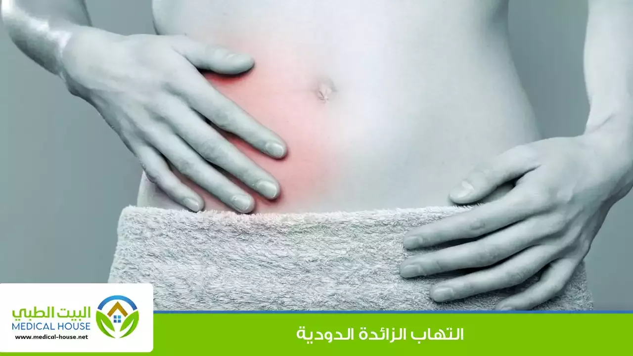 التهاب الزائدة الدودية ـ الاسباب والمضاعفات وطرق العلاج ـ د سارة ابراهيم ـ البيت الطبي