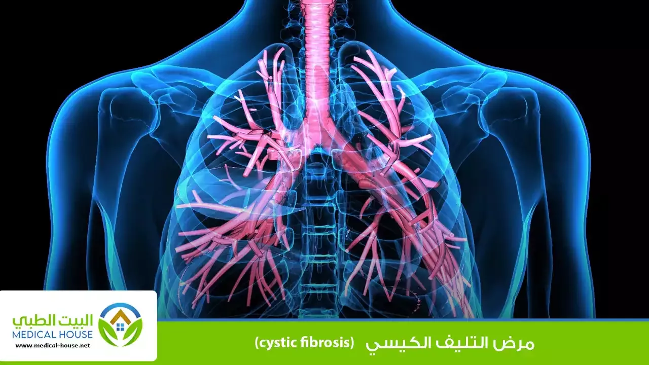التليف الكيسي الاسباب والانواع وطرق العلاج  ـ شريف محمد ـ البيت الطبي
