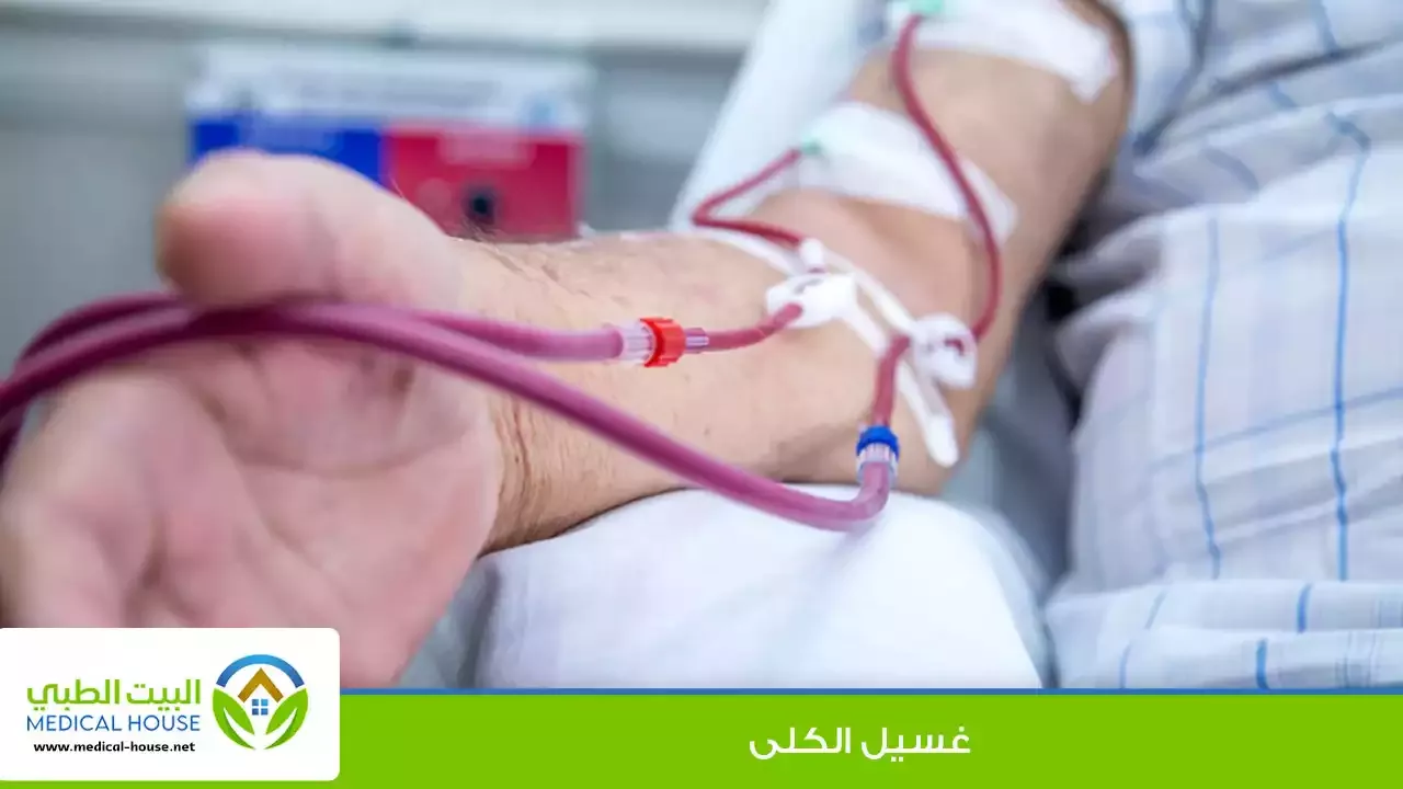 الغسيل الكلوي ـ انواعه وطريقة عمل كل نوع ـ شريف محمد ـ البيت الطبي