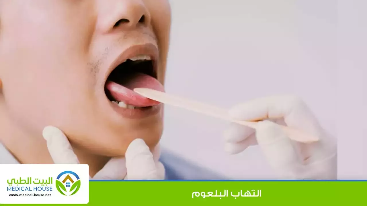 التهاب البلعوم الاسباب وطرق العلاج ـ د سارة ابراهيم ـ البيت الطبي