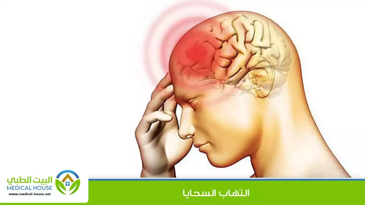التهاب السحايا ـ mengitis ـ كل ما تحتاج لمعرفته عن هذا المرض ـ البيت الطبي