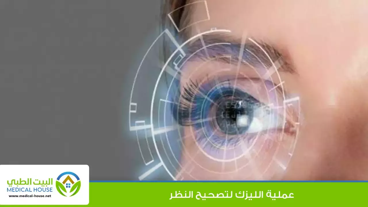 عملية الليزك لتصحيح النظر - الشروط اللازمة لها، كيف تُجرى، ومخاطرها على النظر - البيت الطبي