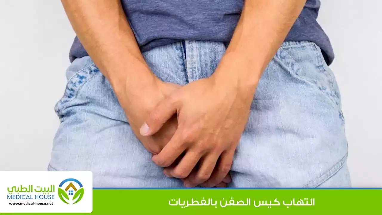 فطريات كيس الصفن - ما هي المسببة لها، عوامل الإصابة، التشخيص، العلاج والوقاية - البيت الطبي