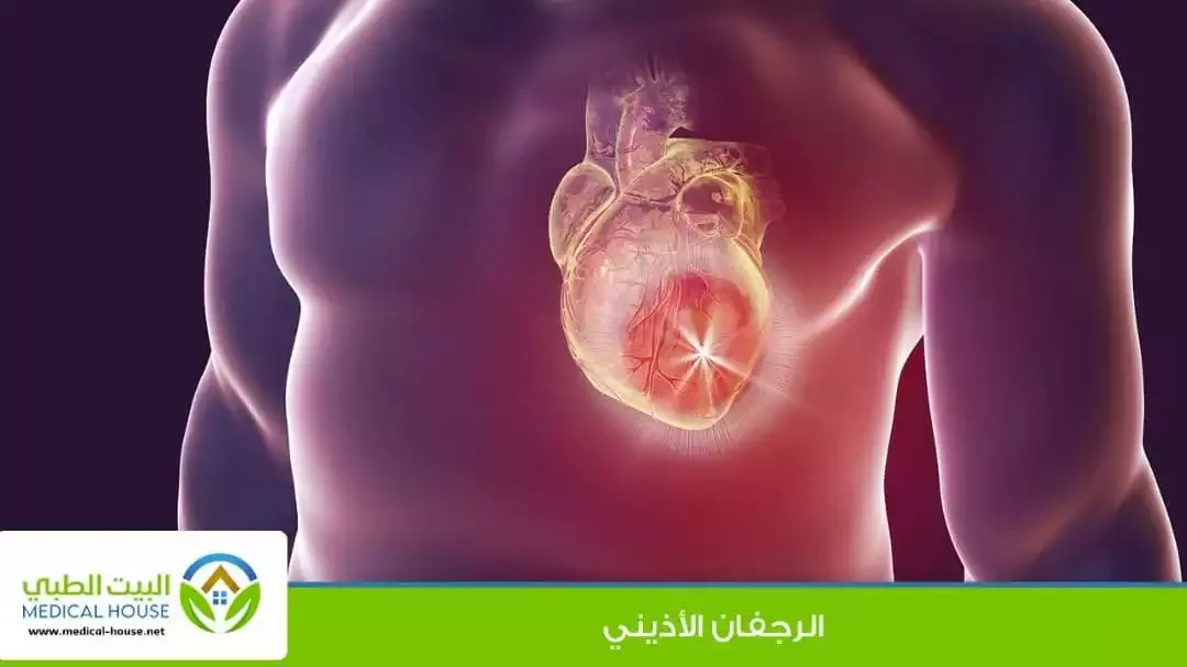 الرجفان الأذيني ، اسبابه وانواعه ومضاعفاته والوقايه