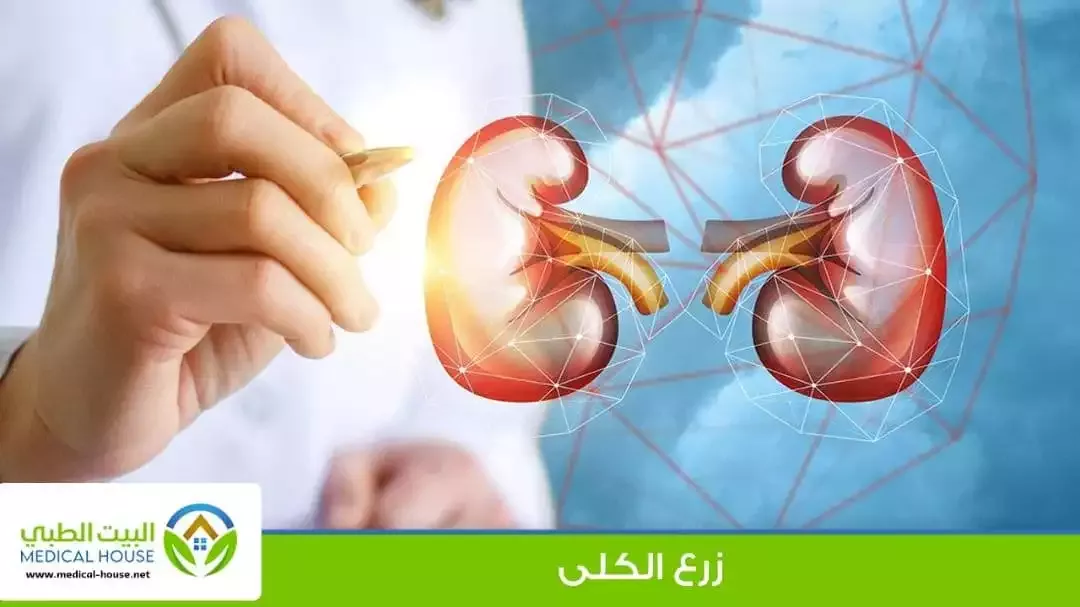 زراعة الكلى هو عملية جراحية يتم إجراؤها لاستبدال كلية مريضة بكلية صحية من متبرع.