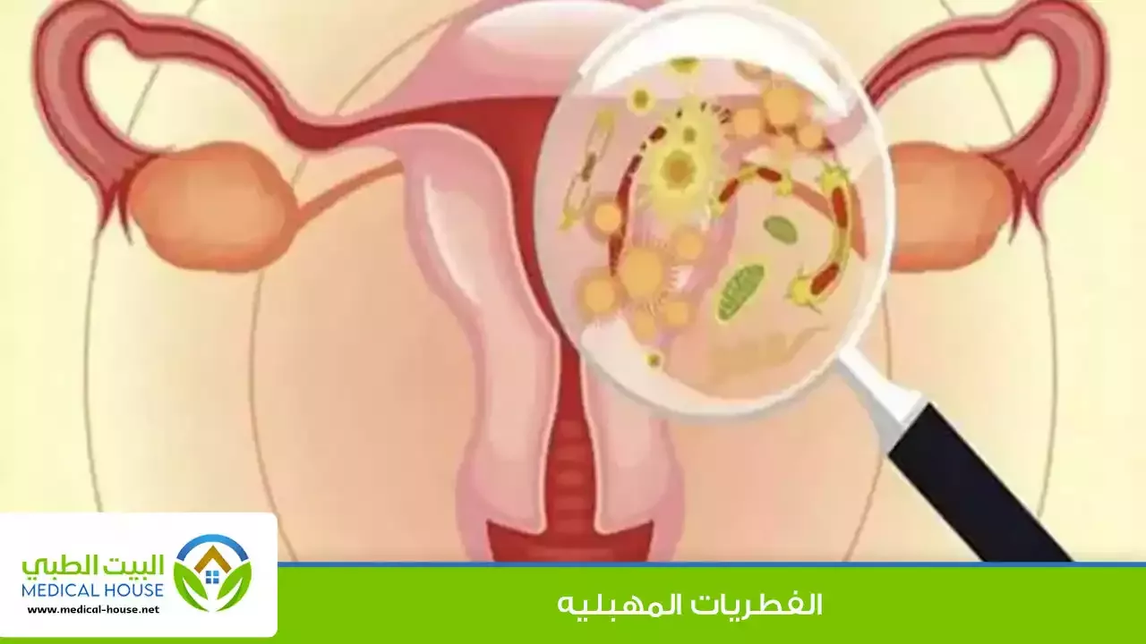 الفطريات المهبلية :عدوى الخميرة المهبلية هي عدوى شائعة جدًا، عدوى فطرية مهبلية.