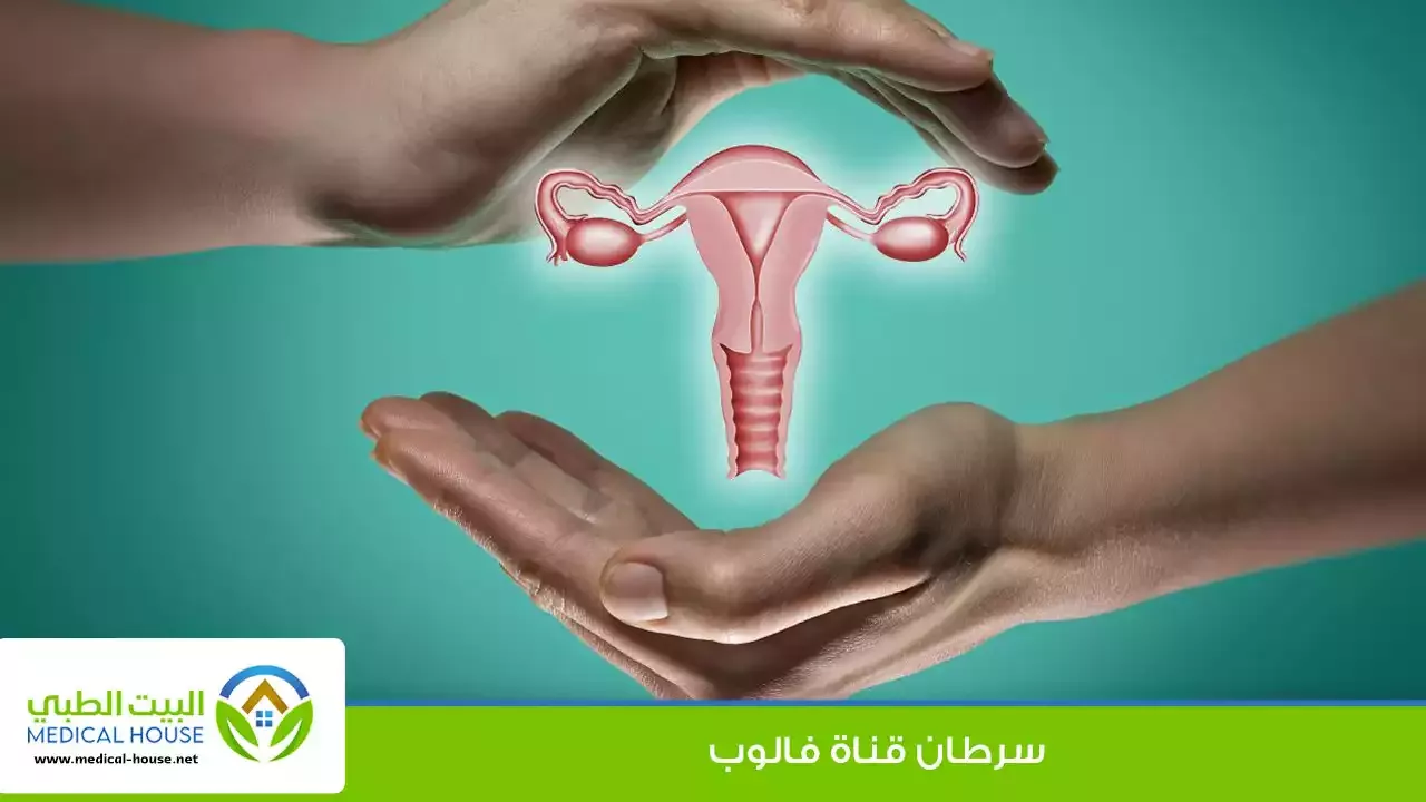 سرطان قناة فالوب جزء من الجهاز التناسلي للمرأة. توجد قناتا فالوب على جانبي الرحم.