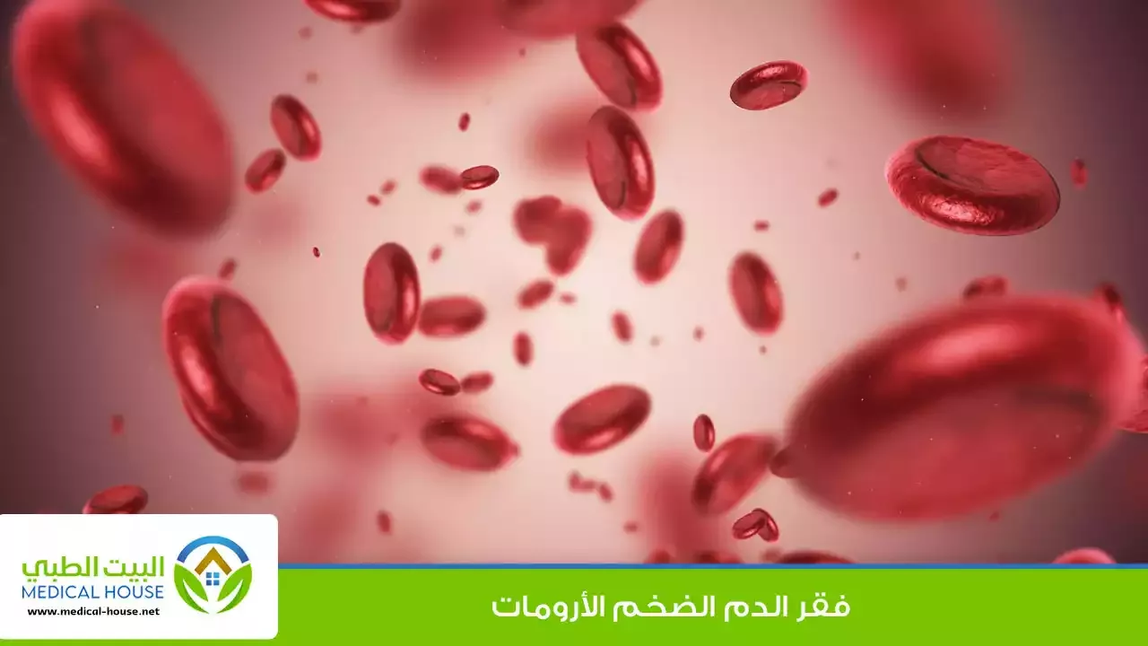 فقر الدم الضخم الأرومات هو حالة ينتج فيها نخاع العظم خلايا دم حمراء كبيرة غير طبيعية وغير ناضجة.