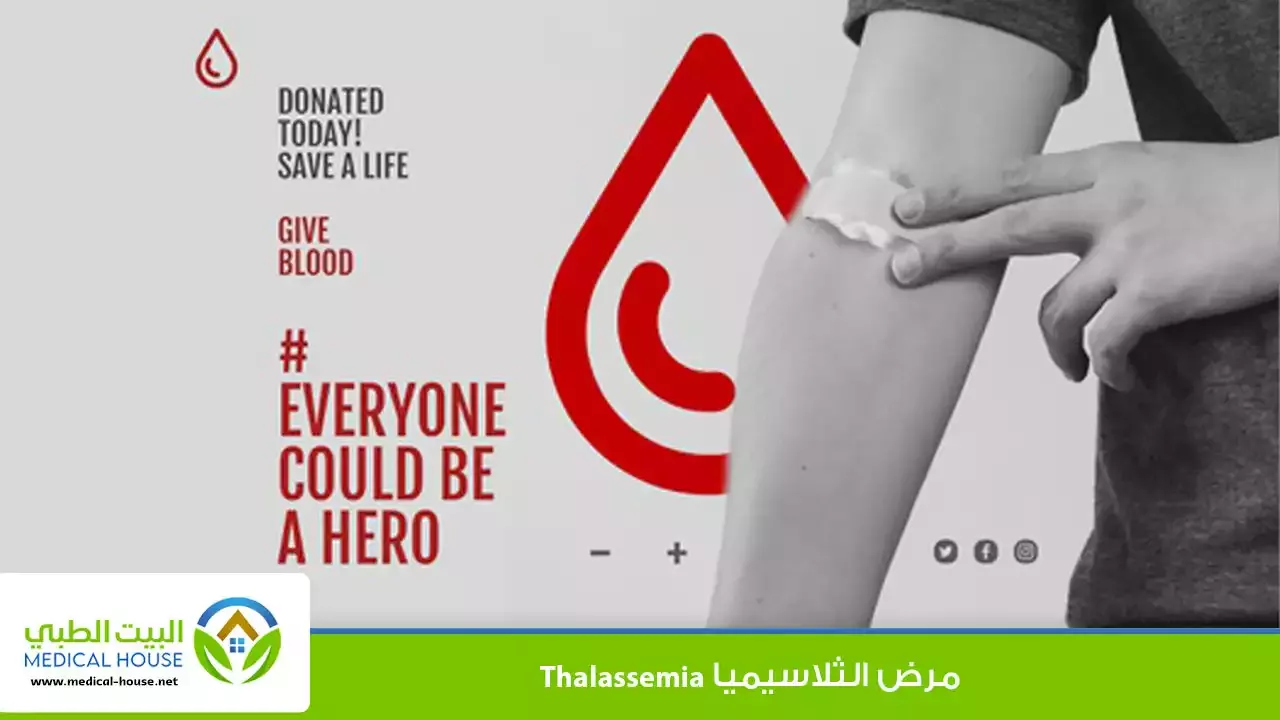 مرض الثلاسيميا ـ  ما تحتاج لمعرفته حول هذا المرض الاسباب وطرق الوقاية ـ البيت الطبي
