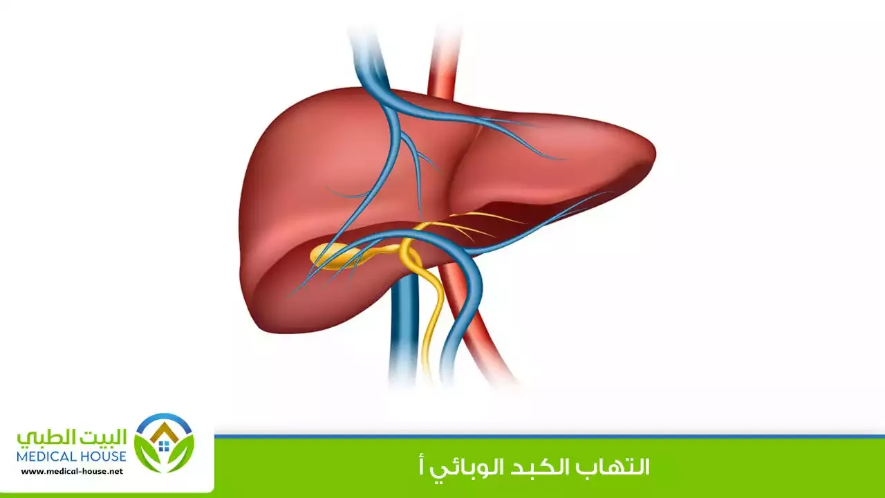 التهاب الكبد أ - Hepatitis A  ـ الاسباب وطرق العلاج البيت الطبي